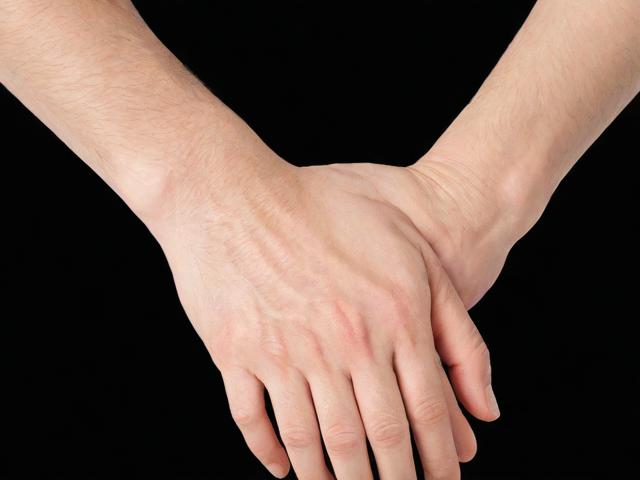 开封腋臭手术多少钱？揭秘腋臭手术费用与专业选择