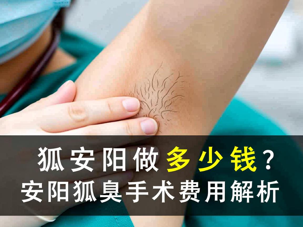 狐臭手术在安阳做多少钱？安阳狐臭手术费用解析