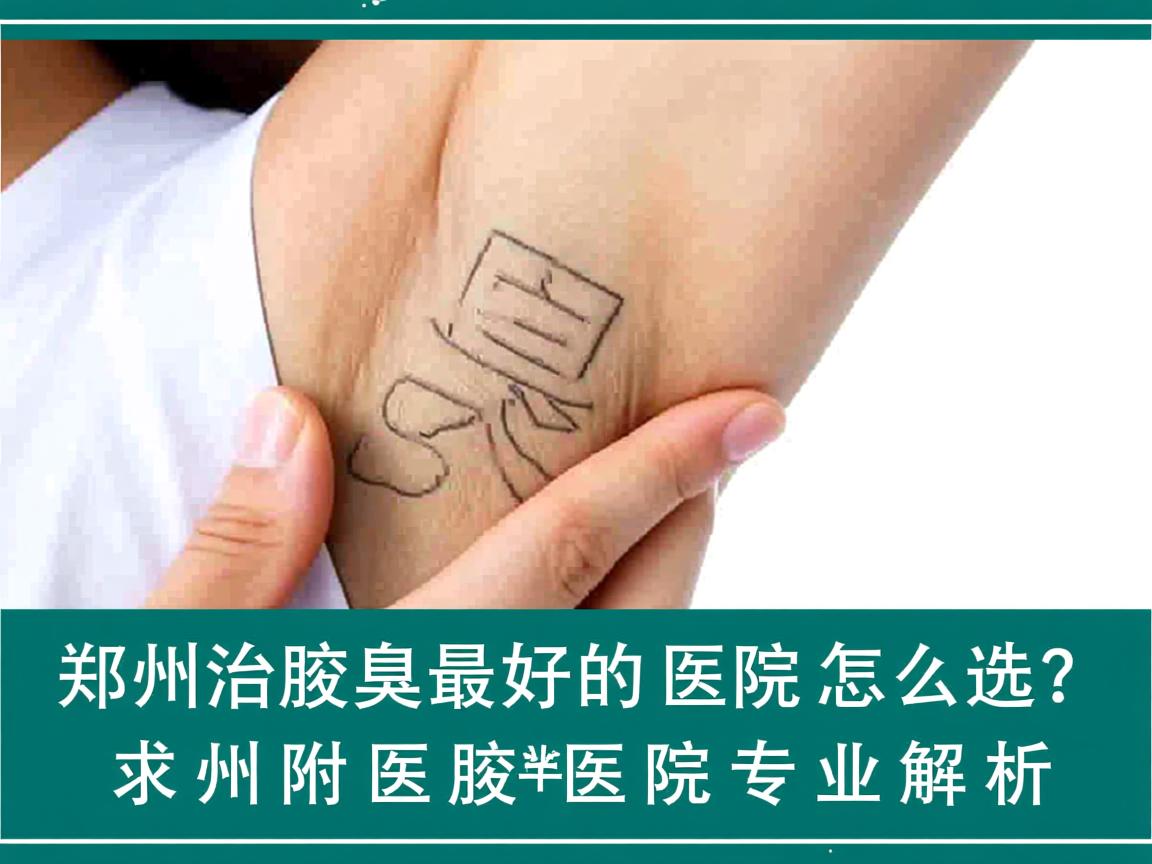 郑州治腋臭最好的医院怎么选?郑州附医腋臭医院专业解析 郑州治腋臭最好的医院怎么选?郑州附医腋臭医院专业解析