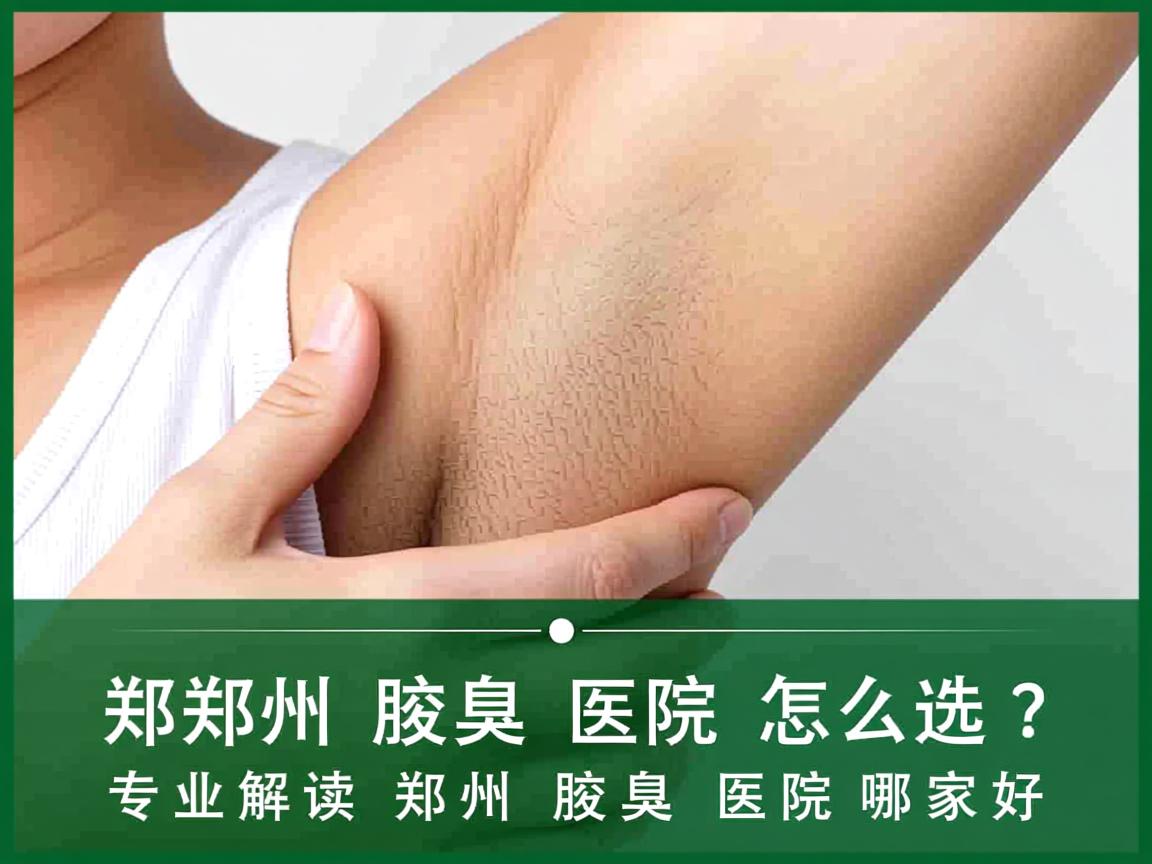 郑州腋臭医院怎么选？专业解读郑州腋臭医院哪家好