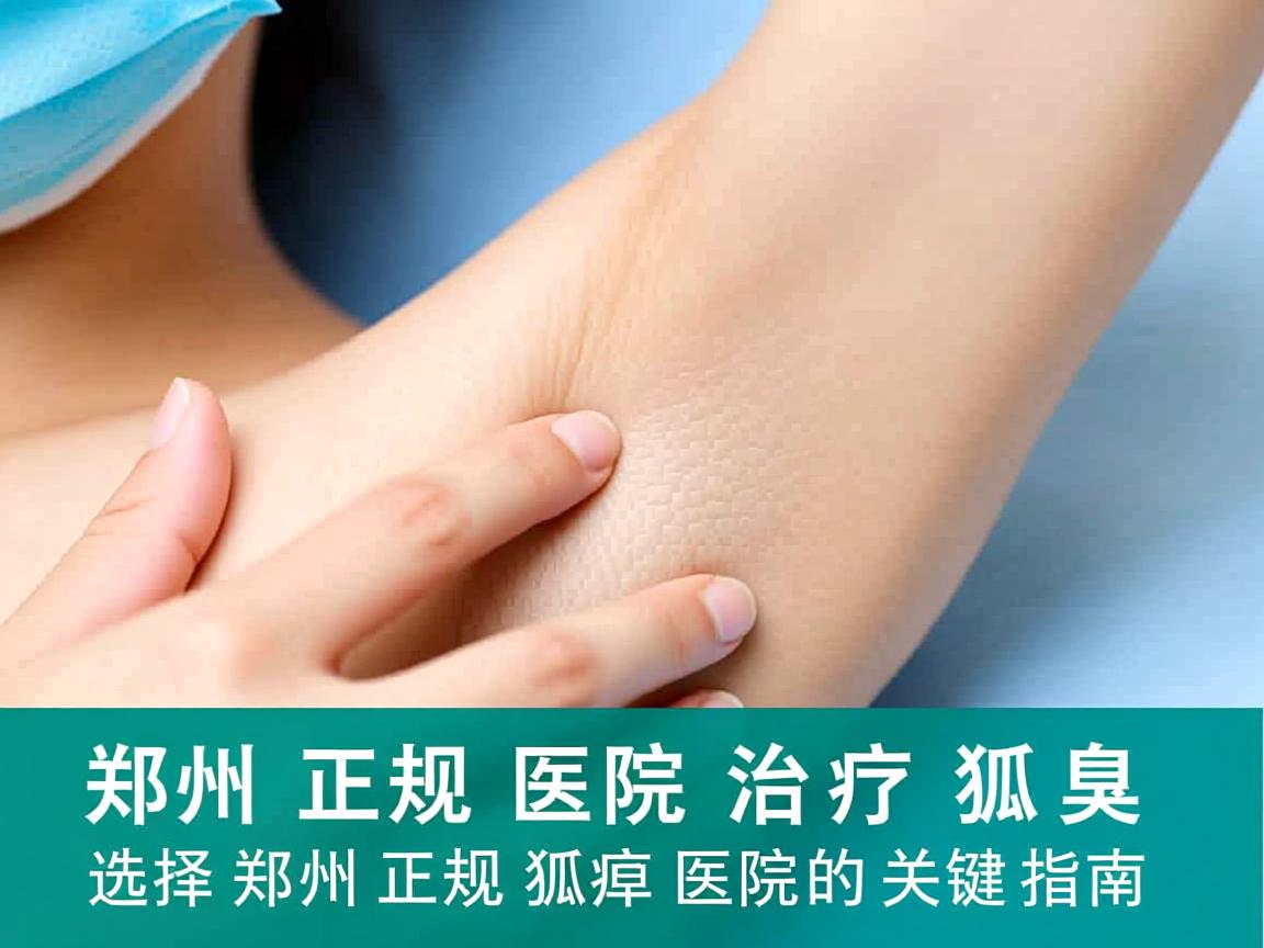 郑州正规医院治疗狐臭,选择郑州正规狐臭医院的关键指南 郑州正规医院治疗狐臭,选择郑州正规狐臭医院的关键指南