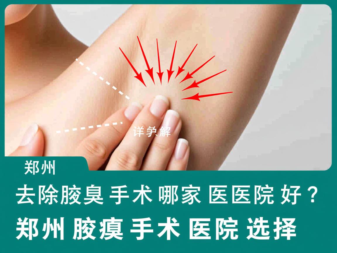 郑州去除腋臭手术哪家医院好？详解郑州腋臭手术医院选择
