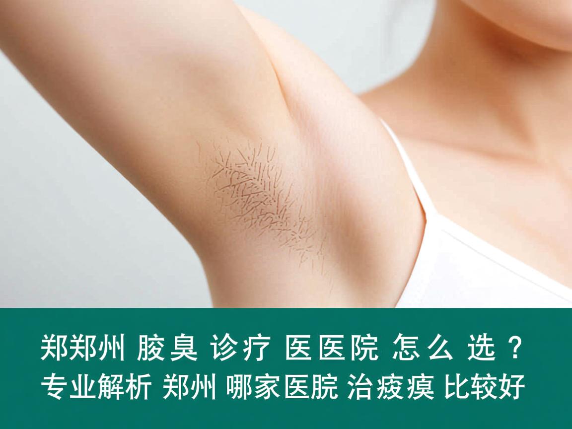郑州腋臭诊疗医院怎么选？专业解析郑州哪家医院治腋臭比较好