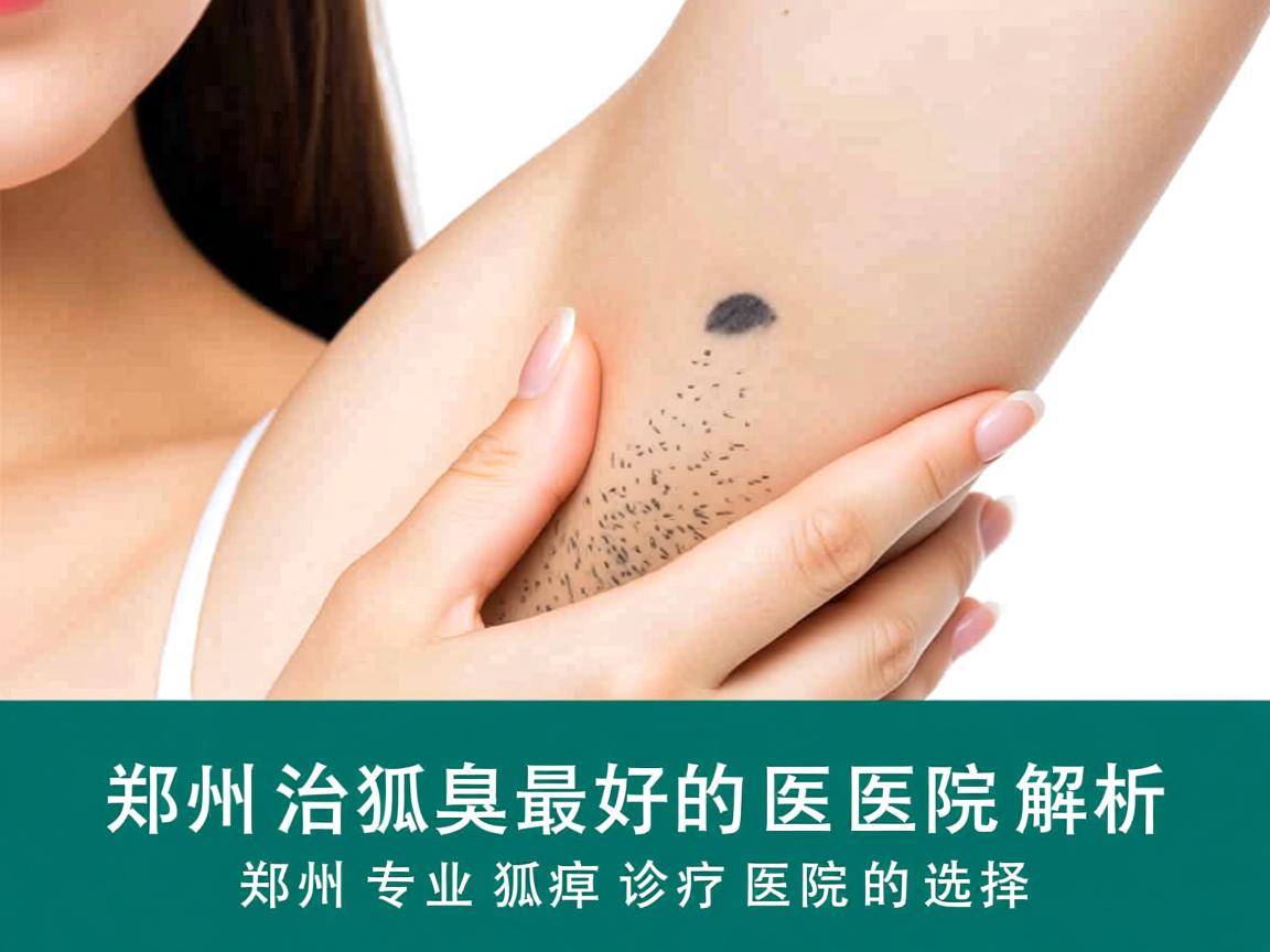 郑州治狐臭最好的医院解析，郑州专业狐臭诊疗医院的选择