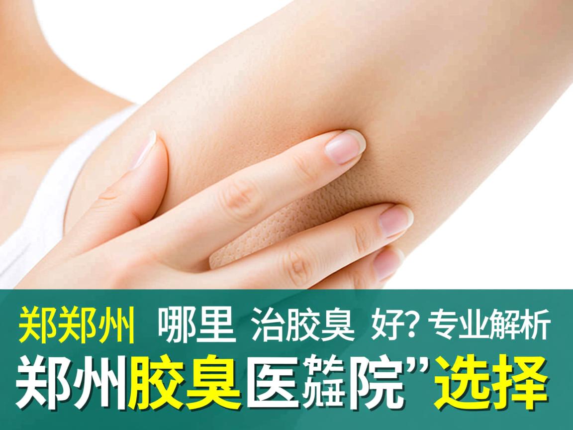 郑州哪里治疗腋臭好？专业解析郑州腋臭医院的选择