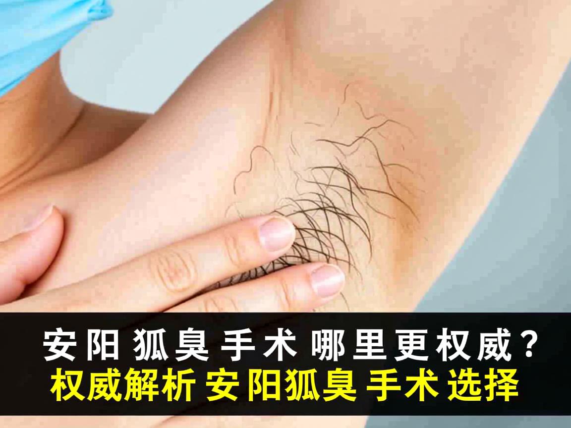 安阳狐臭手术哪里更权威？权威解析安阳狐臭手术选择