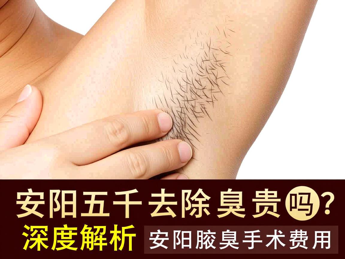 安阳五千去除腋臭贵吗？深度解析安阳腋臭手术费用