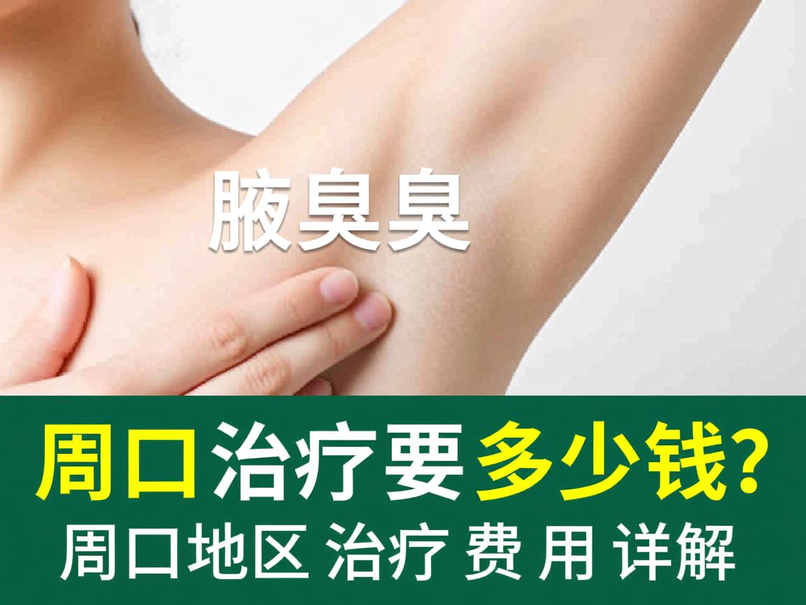 周口腋臭治疗要多少钱？周口地区腋臭治疗费用详解