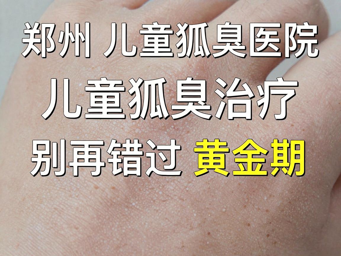 郑州儿童狐臭医院,儿童狐臭治疗,别再错过黄金期 郑州儿童狐臭医院,儿童狐臭治疗,别再错过黄金期