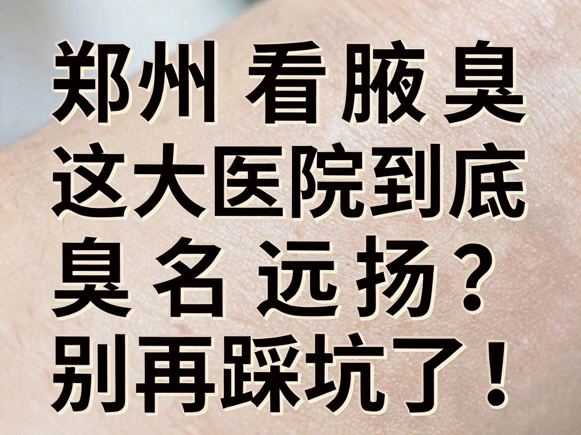 郑州看腋臭，这三大医院到底臭名远扬？别再踩坑了！