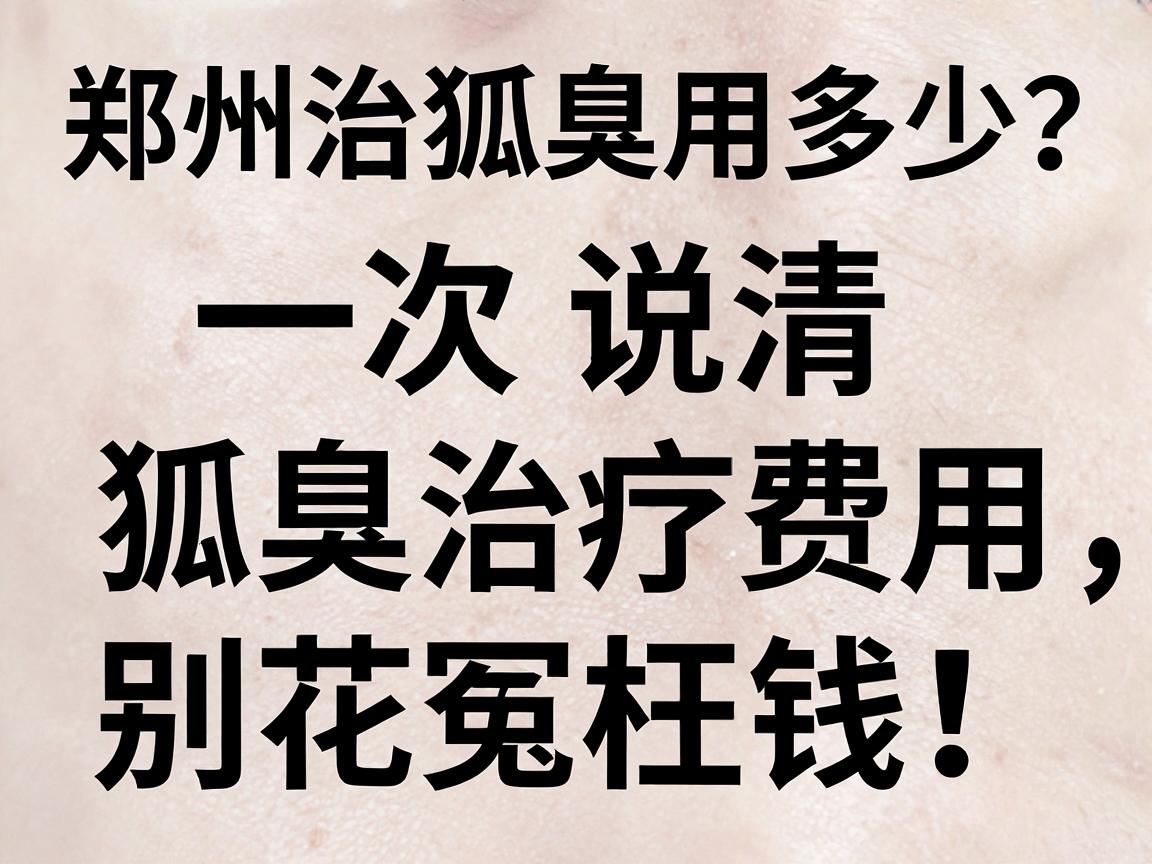 郑州治狐臭费用多少？一次说清狐臭治疗费用，别花冤枉钱！
