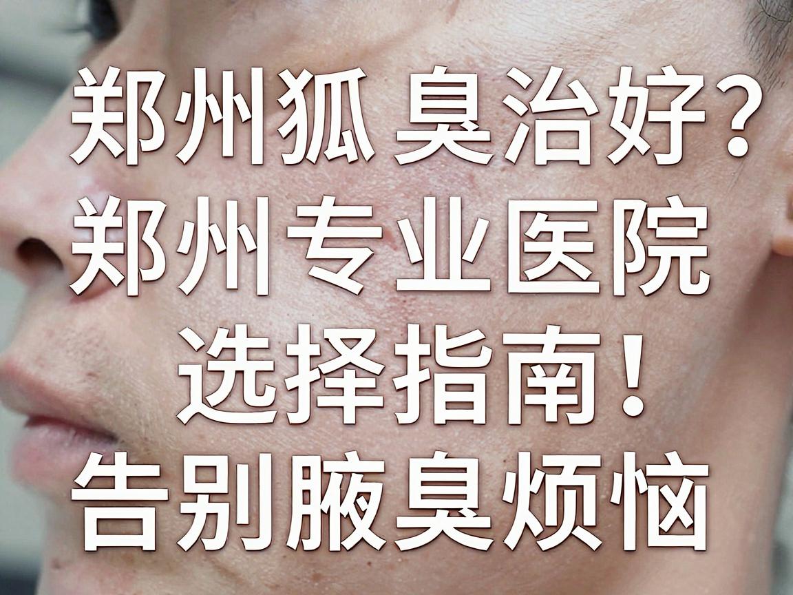 郑州狐臭治疗哪家医院好?郑州专业医院选择指南,告别腋臭烦恼 郑州狐臭治疗哪家医院好?郑州专业医院选择指南,告别腋臭烦恼